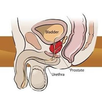 360°全面解析：射精障碍
